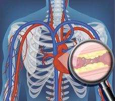 radiografia del corpo umano con organi interni vettore