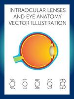 lenti intraoculari e illustrazione vettoriale di anatomia oculare