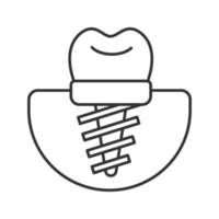 icona lineare dell'impianto dentale. illustrazione al tratto sottile. impianto endosseo. simbolo di contorno. disegno vettoriale isolato