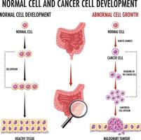 diagramma che mostra le cellule normali e cancerose nell'uomo vettore