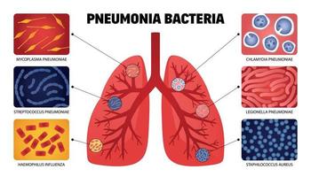 raccolta dei polmoni dei batteri della polmonite vettore